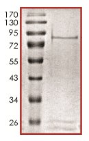 SDS-PAGE - Recombinant human NEK5 protein (AB133140), expandable thumbnail
