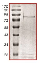 SDS-PAGE - Recombinant human NEK5 protein (AB133140)