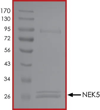 SDS-PAGE - Recombinant human NEK5 protein (AB133140)