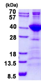 SDS-PAGE - Recombinant Human NEK7 protein (AB136361), expandable thumbnail