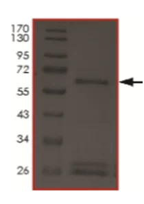 SDS-PAGE - Recombinant human NEK8 protein (AB204141)