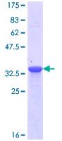SDS-PAGE - Recombinant Human Nephrin protein (AB114263)