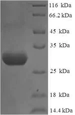 SDS-PAGE - Recombinant Human Nephrin protein (His tag) (AB235806)