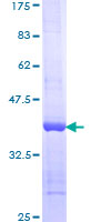 SDS-PAGE - Recombinant Human Nesprin1/Syne-1 protein (GST tag N-Terminus) (AB161609)