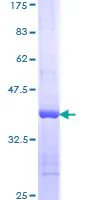 SDS-PAGE - Recombinant Human Nesprin1/Syne-1 protein (GST tag N-Terminus) (AB161609)