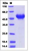 SDS-PAGE - Recombinant Human Netrin G1 protein (His tag) (AB276476)