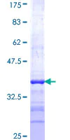 SDS-PAGE - Recombinant Human NEU2 protein (AB116967)