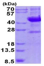 SDS-PAGE - Recombinant Human Neuraminidase protein (His tag N-Terminus) (AB131685)