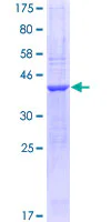 SDS-PAGE - Recombinant Human Neurexin 1 protein (GST tag N-Terminus) (AB160463)