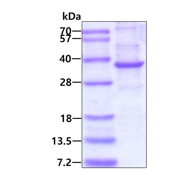 SDS-PAGE - Recombinant Human NEURL2 protein (denatured) (AB171589)