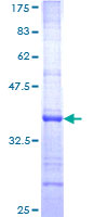 SDS-PAGE - Recombinant Human Neurocan protein (GST tag N-Terminus) (AB152304)
