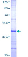 SDS-PAGE - Recombinant Human Neurocan protein (GST tag N-Terminus) (AB152304)