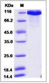 SDS-PAGE - Recombinant Human Neurofascin protein (His tag) (AB276683), expandable thumbnail