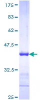 SDS-PAGE - Recombinant Human Neurofilament heavy polypeptide protein (GST tag N-Terminus) (AB158986)