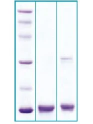 SDS-PAGE - Recombinant Human Neuroglobin protein (AB63278)