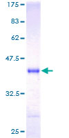 Recombinant Human Neurogranin protein