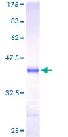 SDS-PAGE - Recombinant Human Neurogranin protein (AB114665)