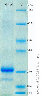 SDS-PAGE - Recombinant Human Neurogranin Protein Standard (His tag) (AB316609)
