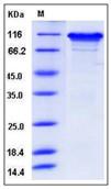 SDS-PAGE - Recombinant Human Neuroligin 3 protein (His tag) (AB276363), expandable thumbnail