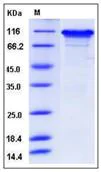 SDS-PAGE - Recombinant Human Neuroligin 3 protein (His tag) (AB276363)
