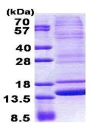 SDS-PAGE - Recombinant Human Neuromedin B protein (denatured) (His tag N-Terminus) (AB167850)