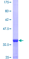 Recombinant Human Neuropeptide Y protein