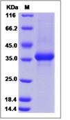 SDS-PAGE - Recombinant Human Neuropeptide Y protein (Fc Chimera) (AB276342)
