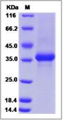 SDS-PAGE - Recombinant Human Neuropeptide Y protein (Fc Chimera) (AB276342)