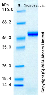 SDS-PAGE - Recombinant Human Neuroserpin Protein Standard (His tag) (AB316500)
