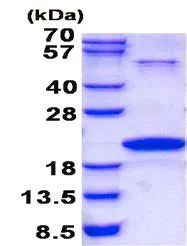 SDS-PAGE - Recombinant Human Neurotensin protein (denatured) (AB139239)