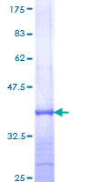 Recombinant Human Neutrophil Elastase protein