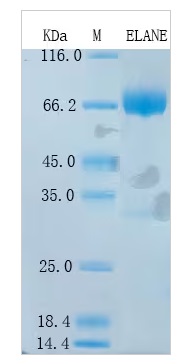 SDS-PAGE - Recombinant Human Neutrophil Elastase Protein Standard (His tag) (AB316383)