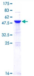 SDS-PAGE - Recombinant Human NF-kB p65 protein (Tagged) (AB114150)