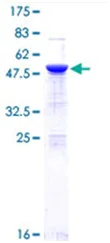 SDS-PAGE - Recombinant Human NF-kB p65 protein (Tagged) (AB114150)