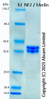 SDS-PAGE - Recombinant Human NF2 / Merlin Protein Standard (His tag) (AB323115)