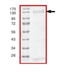 SDS-PAGE - Recombinant Human NFAT2 protein (AB64307)