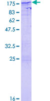SDS-PAGE - Recombinant Human NFAT4/NF-ATc3 protein (GST tag N-Terminus) (AB114667)