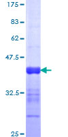 SDS-PAGE - Recombinant Human NFAT5 protein (AB112396), expandable thumbnail