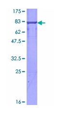 Recombinant Human NFIX/CTF protein