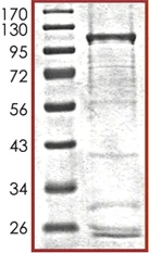 SDS-PAGE - Recombinant human NFkB Inducing Kinase NIK protein (AB105210)