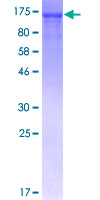 Recombinant Human NFkB p105 / p50 protein