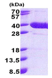 SDS-PAGE - Recombinant Human NFKBID protein (His tag N-Terminus) (AB171676)