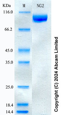 SDS-PAGE - Recombinant Human NG2 Protein Standard (His tag) (AB323024), expandable thumbnail