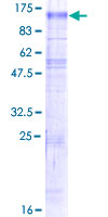 SDS-PAGE - Recombinant Human NHE-6 protein (AB161011), expandable thumbnail