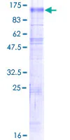 SDS-PAGE - Recombinant Human NHE-6 protein (GST tag N-Terminus) (AB161011)