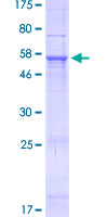 SDS-PAGE - Recombinant Human NHLRC3 protein (AB166407), expandable thumbnail