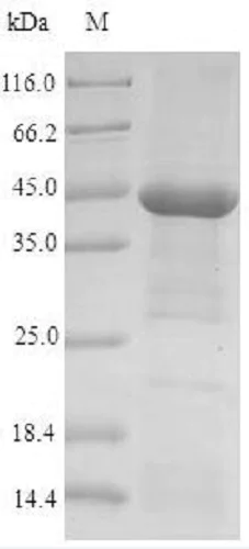 SDS-PAGE - Recombinant Human Nicotinic Acetylcholine Receptor alpha 1/CHRNA1 protein (Tagged) (AB235737)
