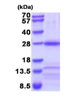 SDS-PAGE - Recombinant Human Nicotinic Acetylcholine Receptor alpha 3/CHRNA3 protein(denatured)(His tag N-Term) (AB202147)