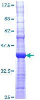 Recombinant Human Nicotinic Acetylcholine Receptor alpha 5/CHRNA5 protein