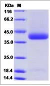 SDS-PAGE - Recombinant Human Nicotinic Acetylcholine Receptor alpha 5/CHRNA5 protein (His tag) (AB276630)